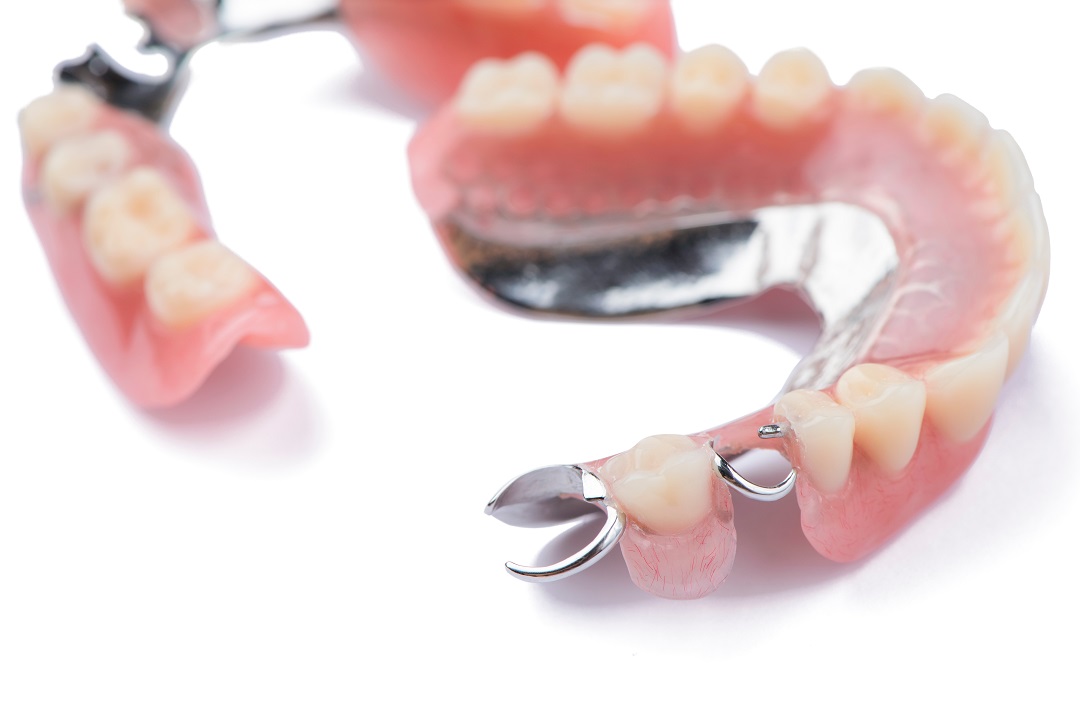 Zahnprothese mit Metallklammer