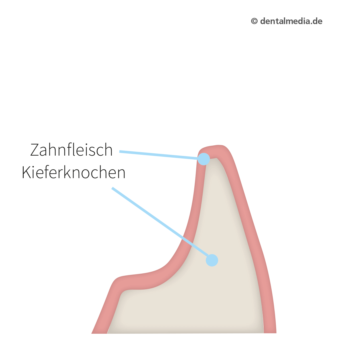 Die Grafik zeigt den Ausgangszustand vor der Behandlung.