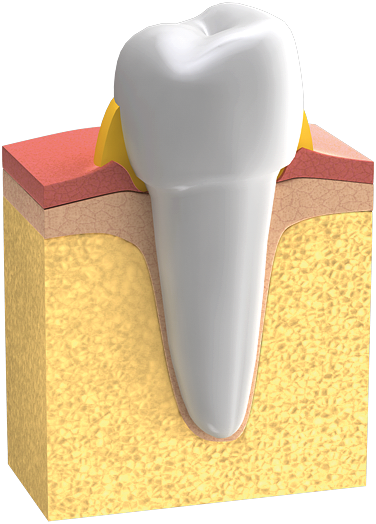 Parodontologie – wie erkennt man erkranktes Zahnfleisch?