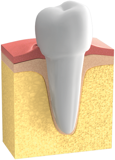 Gesundes Zahnfleisch – ohne Parodontitis.